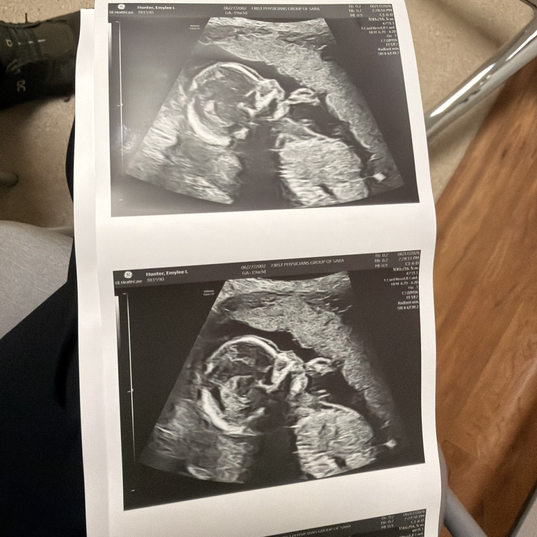 Photo shared by Emylee for their Babylist baby registry.