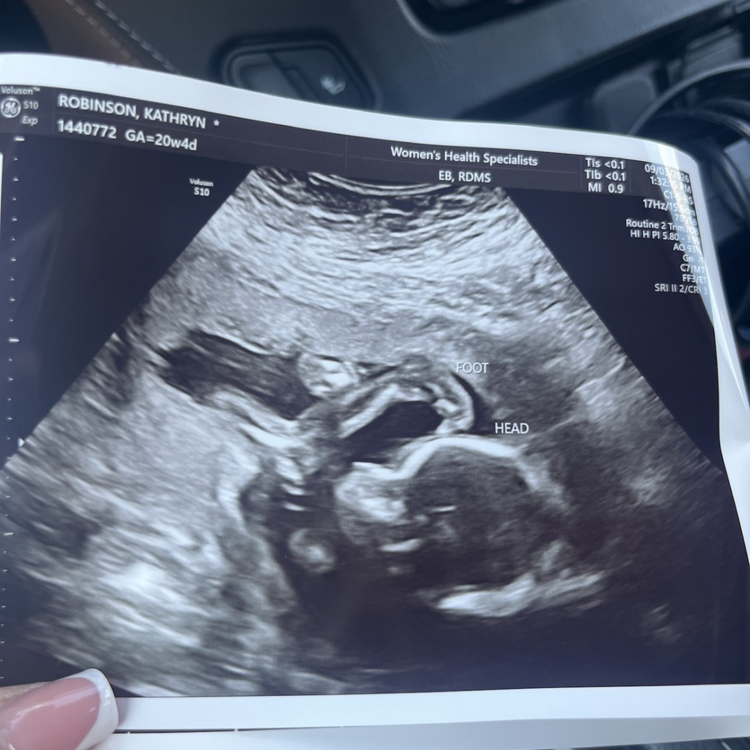 Photo shared by Kathryn for their Babylist baby registry.
