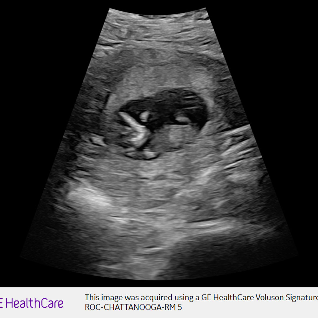 Photo shared by Elizabeth for their Babylist baby registry.