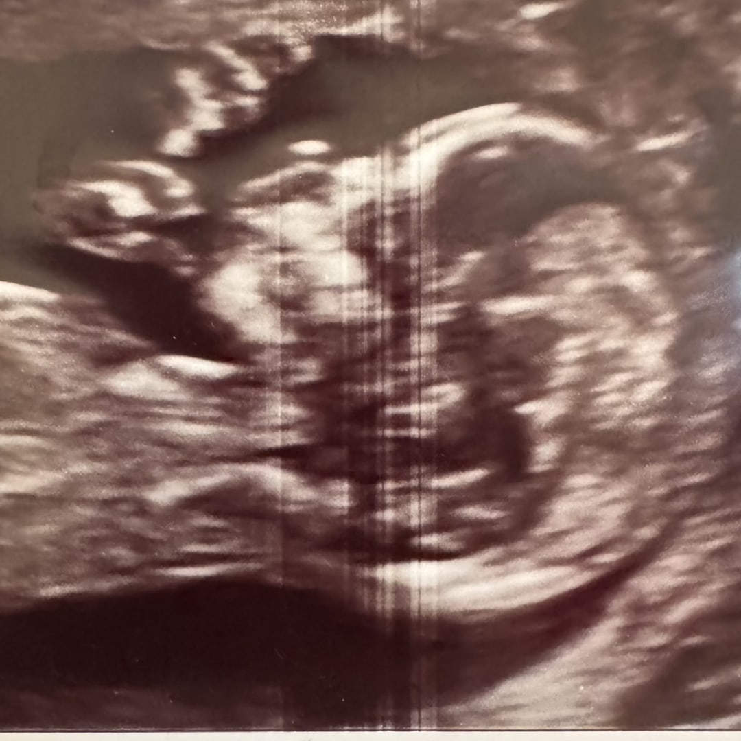 Photo shared by Candela for their Babylist baby registry.