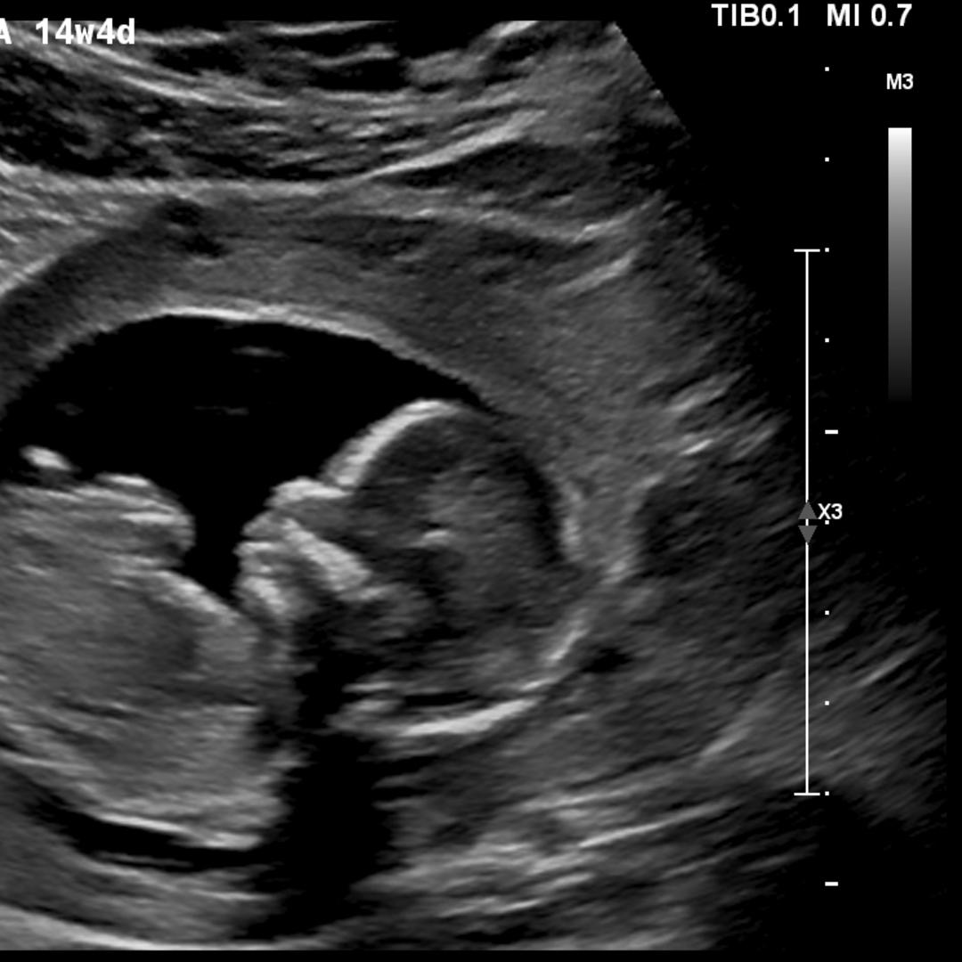 Photo shared by Tyler for their Babylist baby registry.