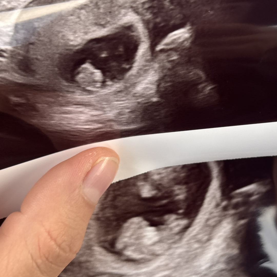 Photo shared by Jada for their Babylist baby registry.
