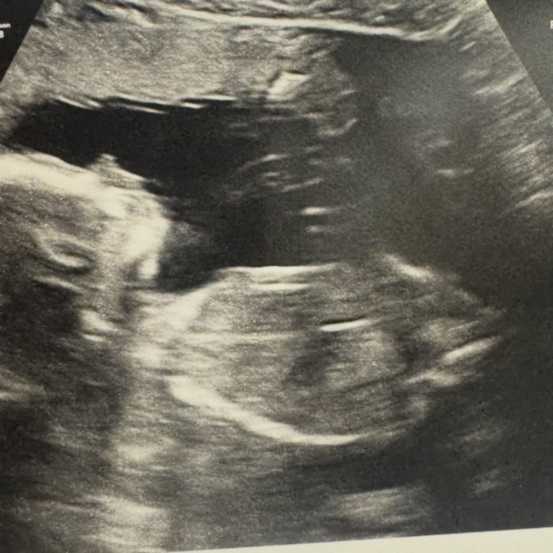 Photo shared by Hailey for their Babylist baby registry.