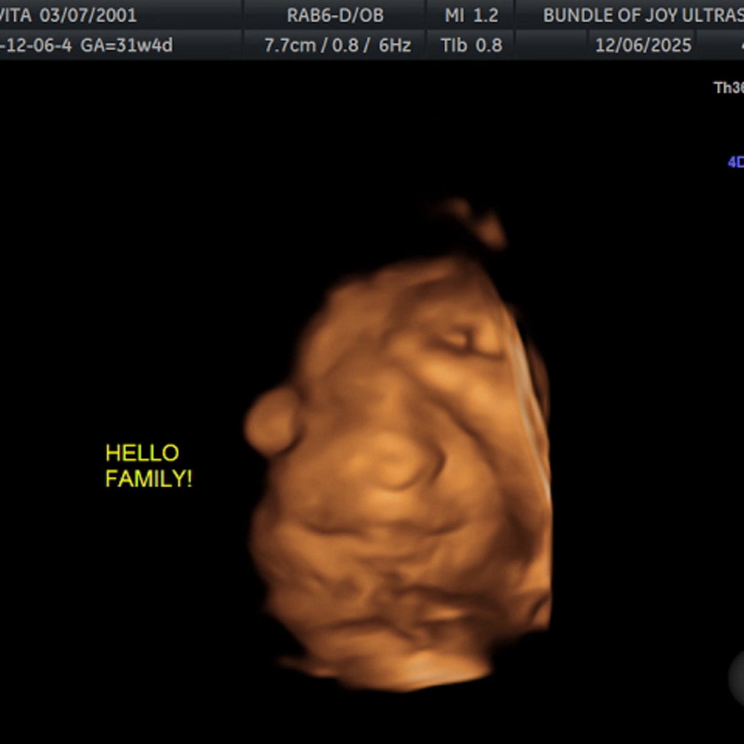 Photo shared by Vita for their Babylist baby registry.