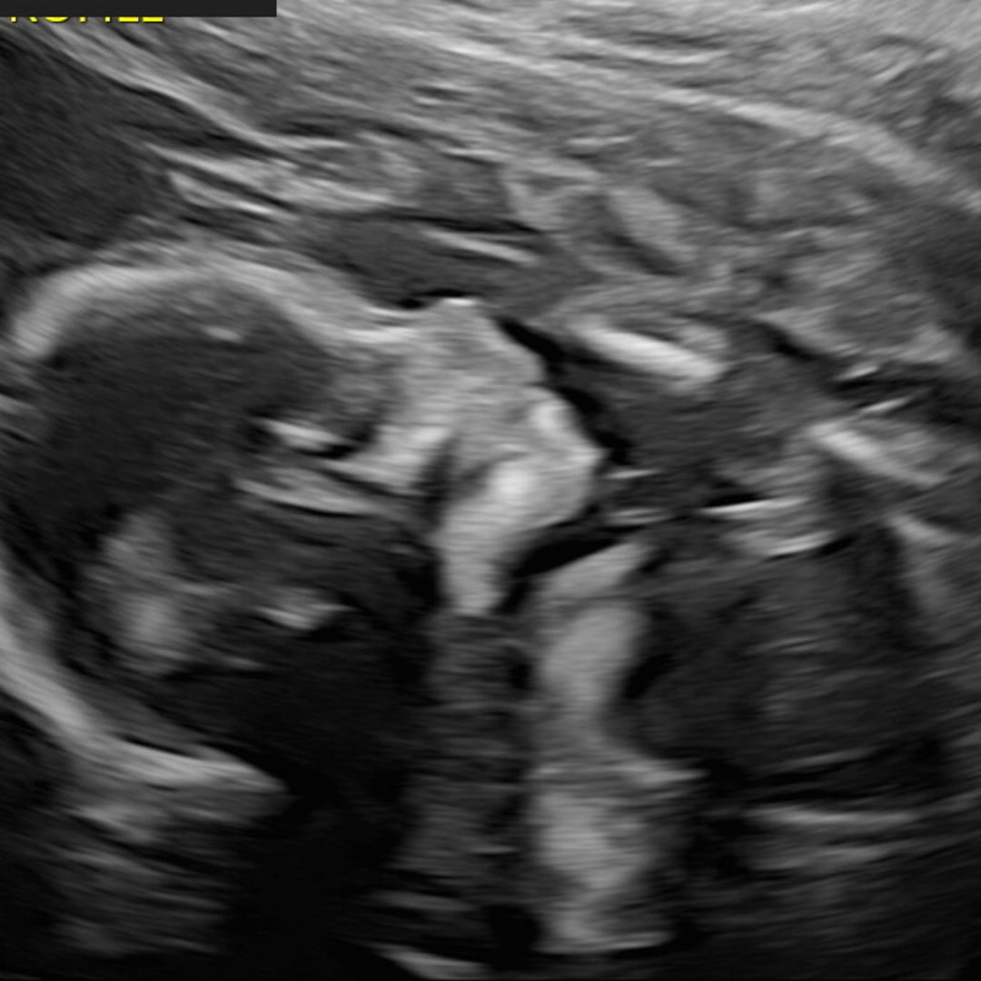 Photo shared by Jalissa for their Babylist baby registry.