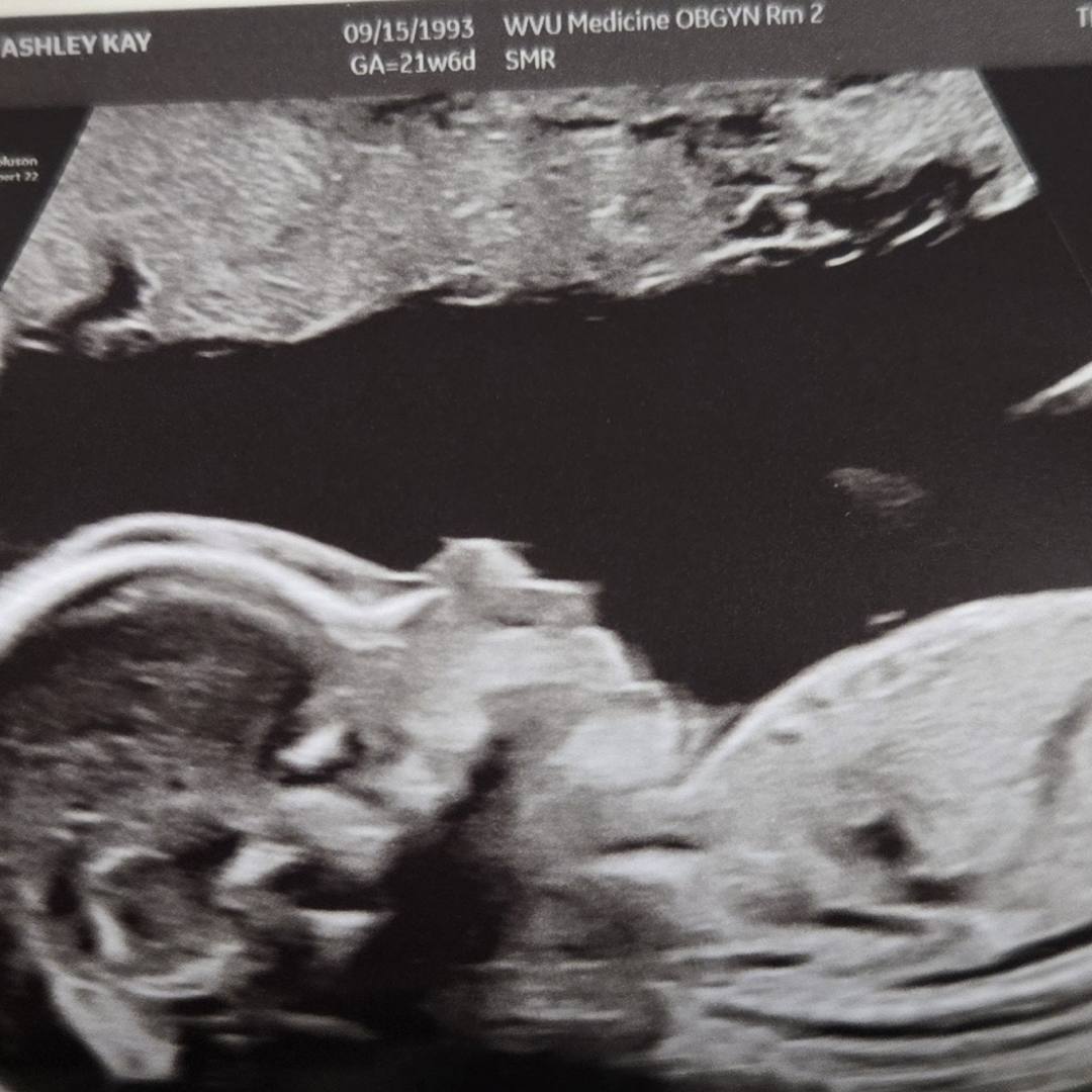 Photo shared by Ashley for their Babylist baby registry.