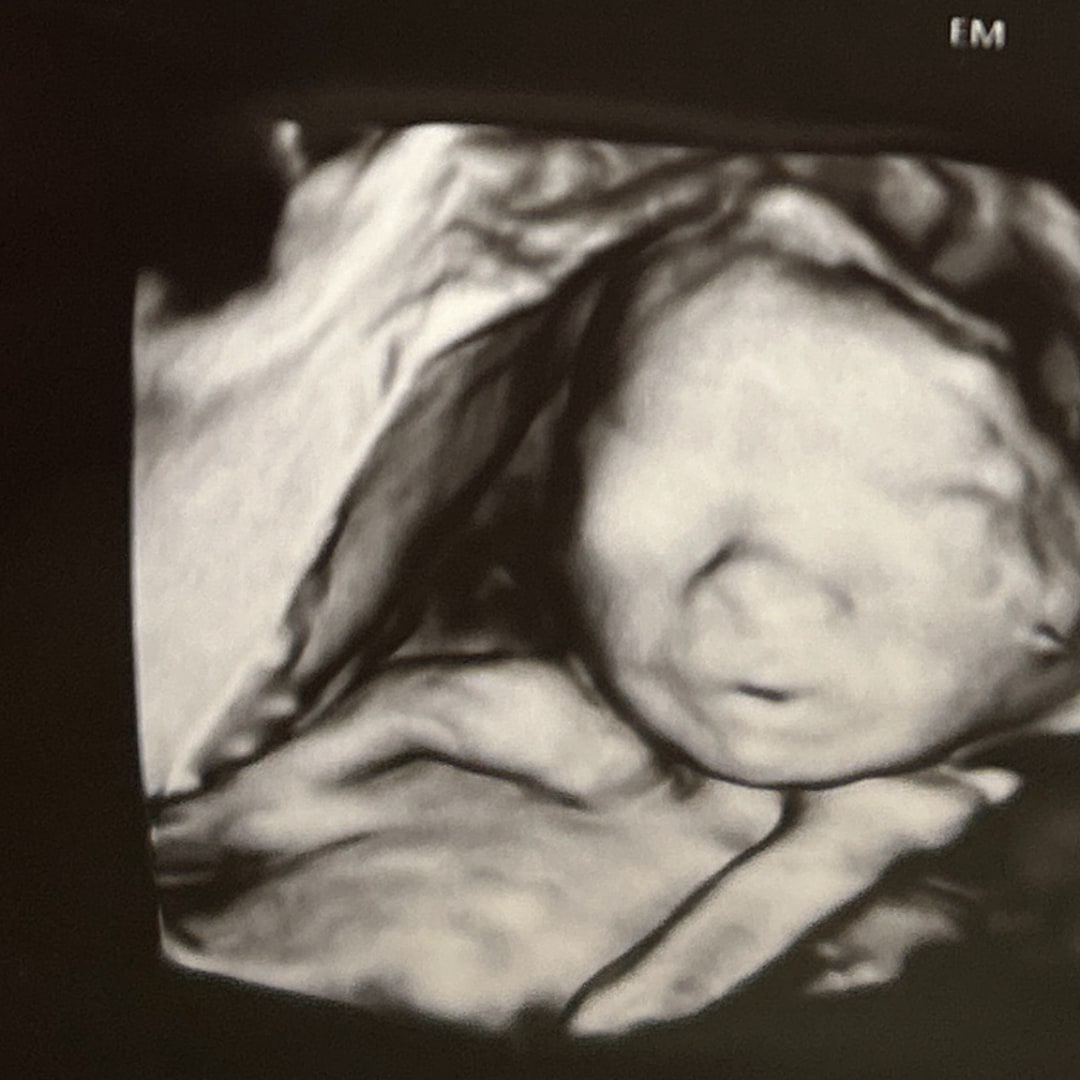 Photo shared by Melissa for their Babylist baby registry.