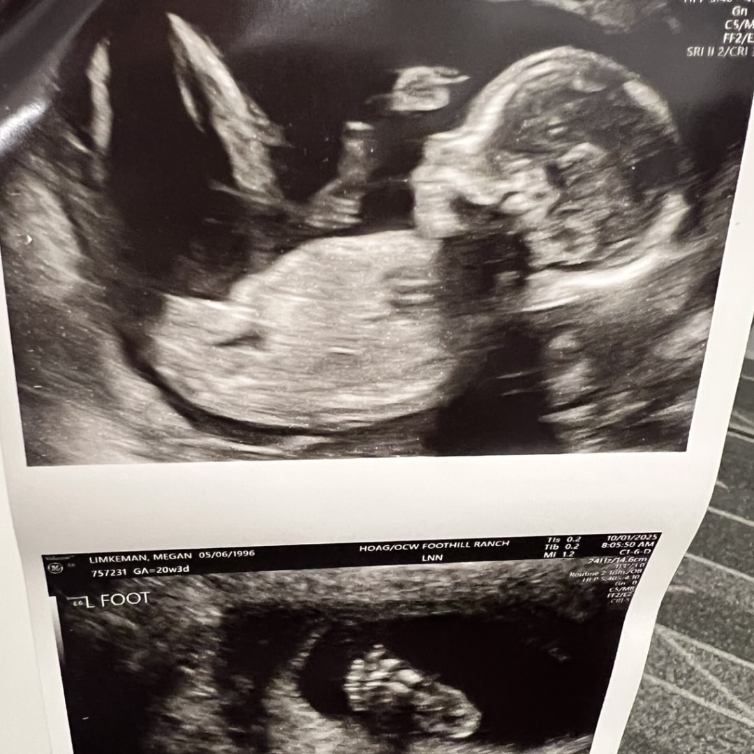 Photo shared by Megan for their Babylist baby registry.