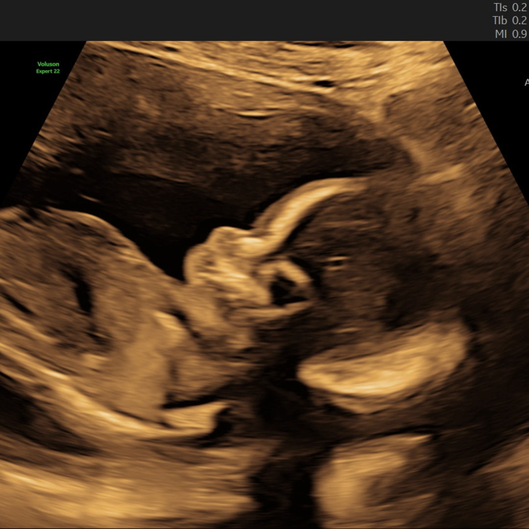 Photo shared by LaDonna for their Babylist baby registry.
