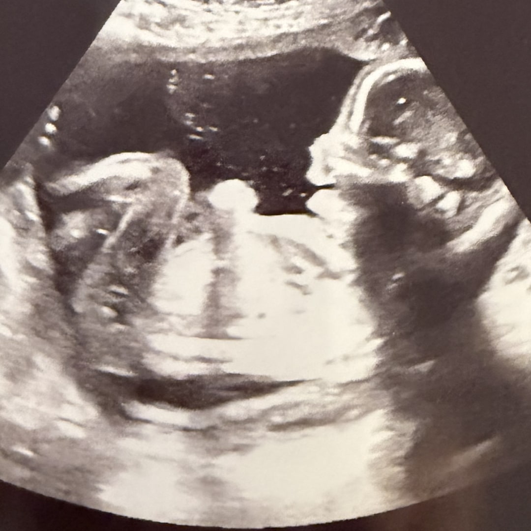 Photo shared by Brena for their Babylist baby registry.