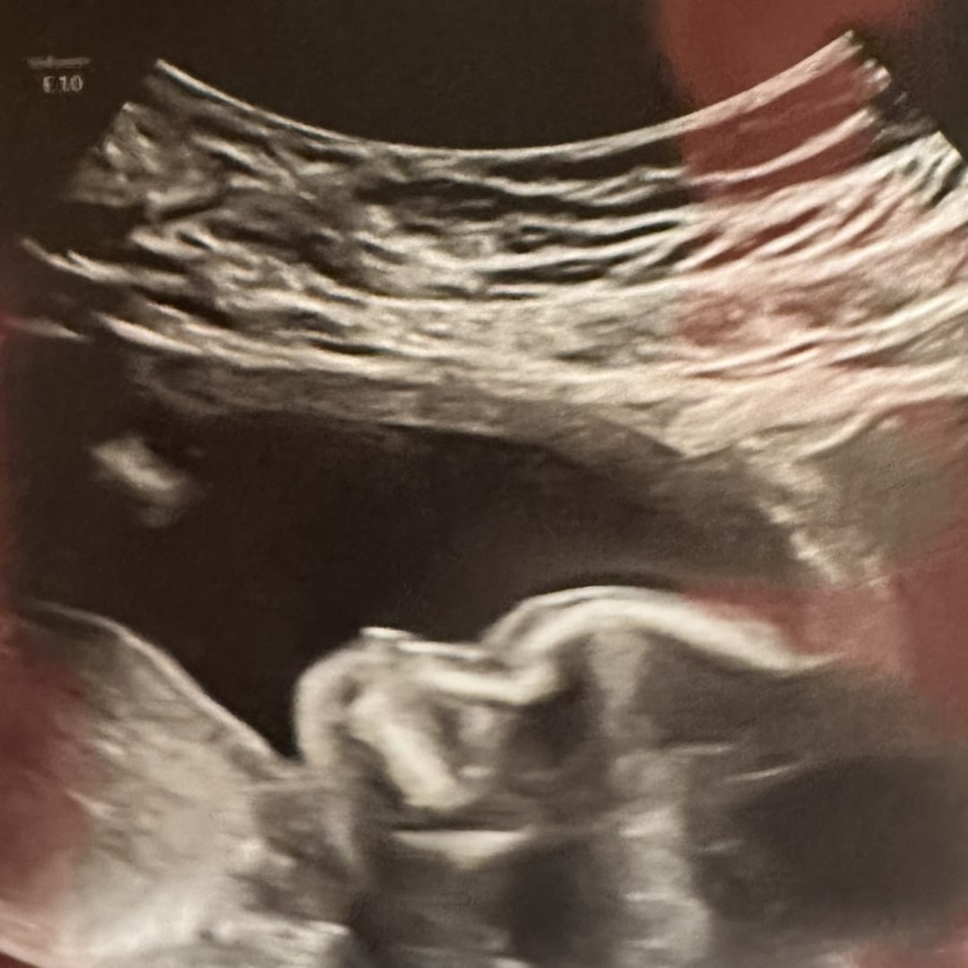 Photo shared by Amber for their Babylist baby registry.
