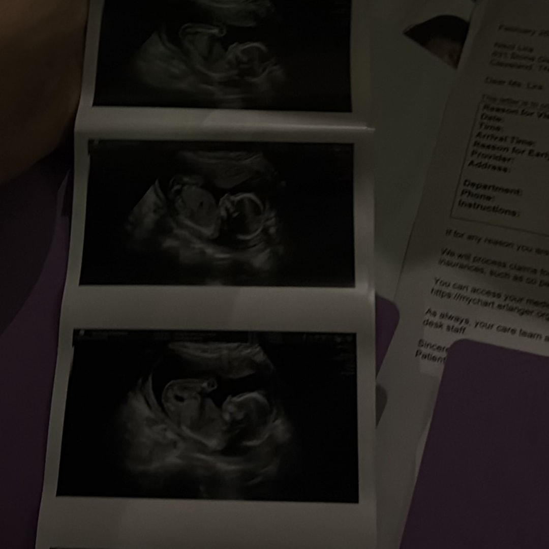 Photo shared by Nicol for their Babylist baby registry.