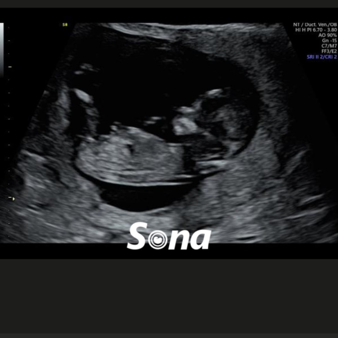 Photo shared by Rachel for their Babylist baby registry.