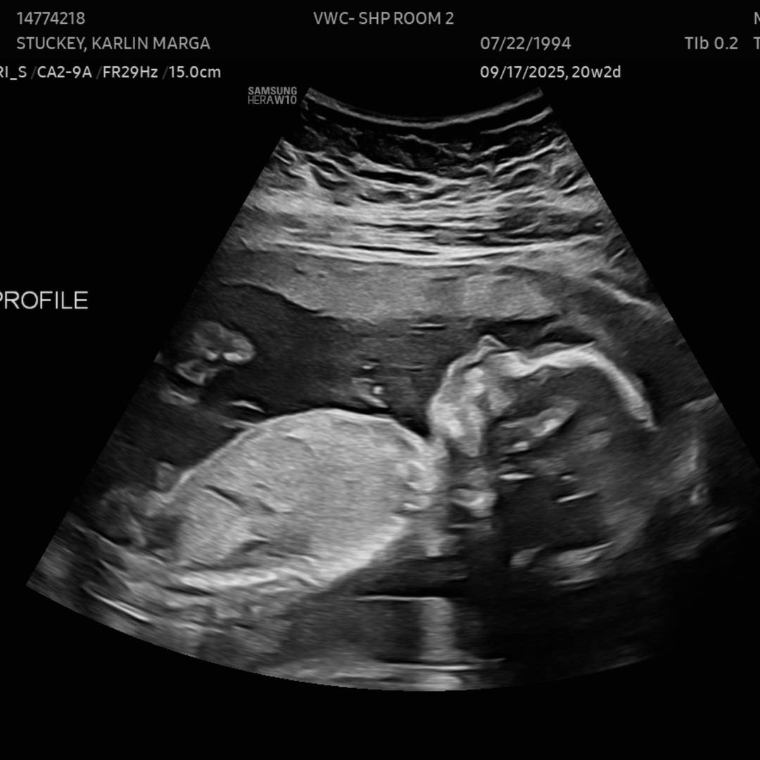 Photo shared by Karlin for their Babylist baby registry.
