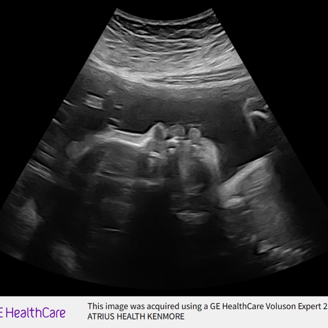 Photo shared by Bridgett for their Babylist baby registry.