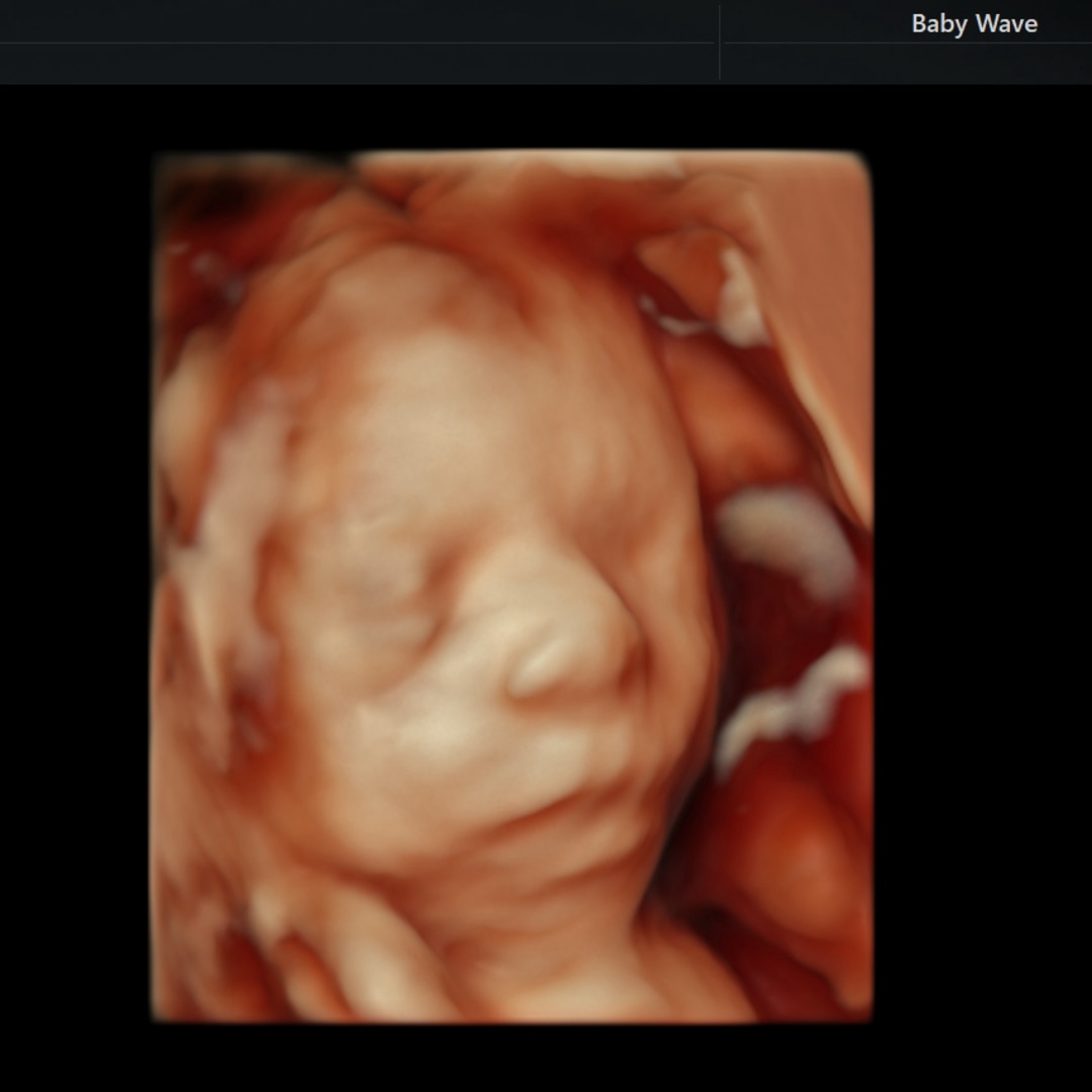 Photo shared by Renee for their Babylist baby registry.