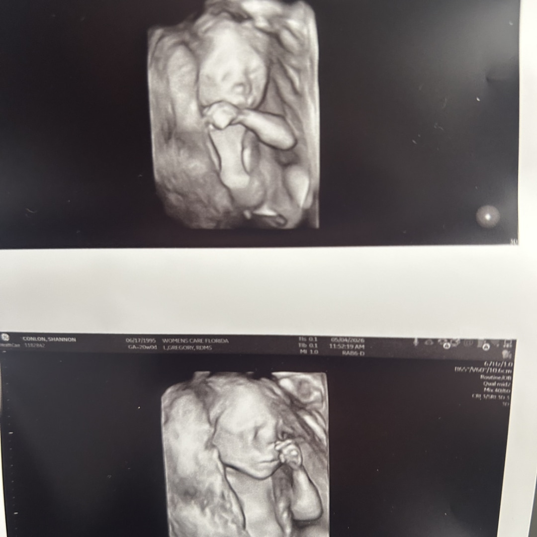 Photo shared by Shannon for their Babylist baby registry.