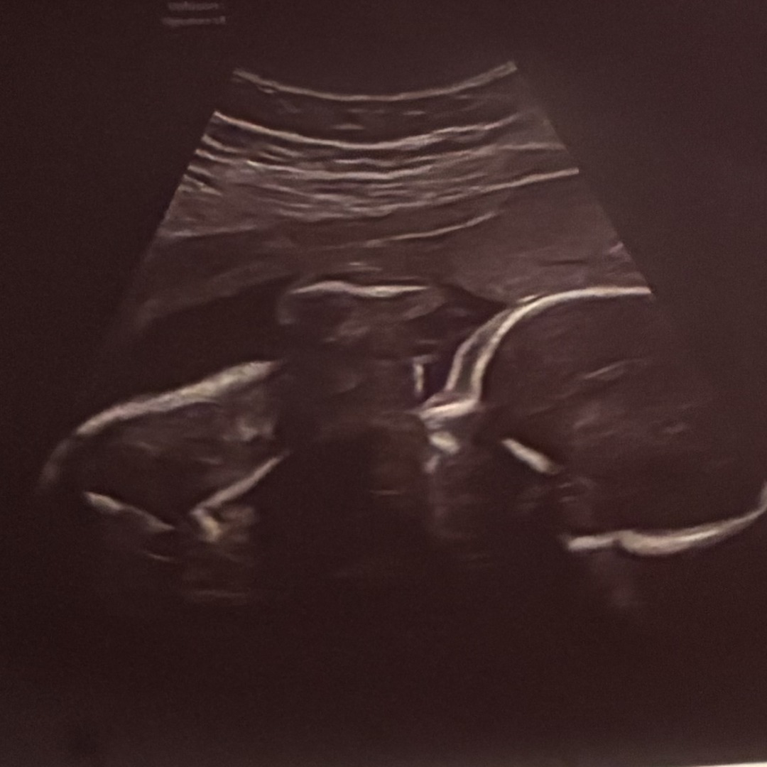 Photo shared by Heather for their Babylist baby registry.