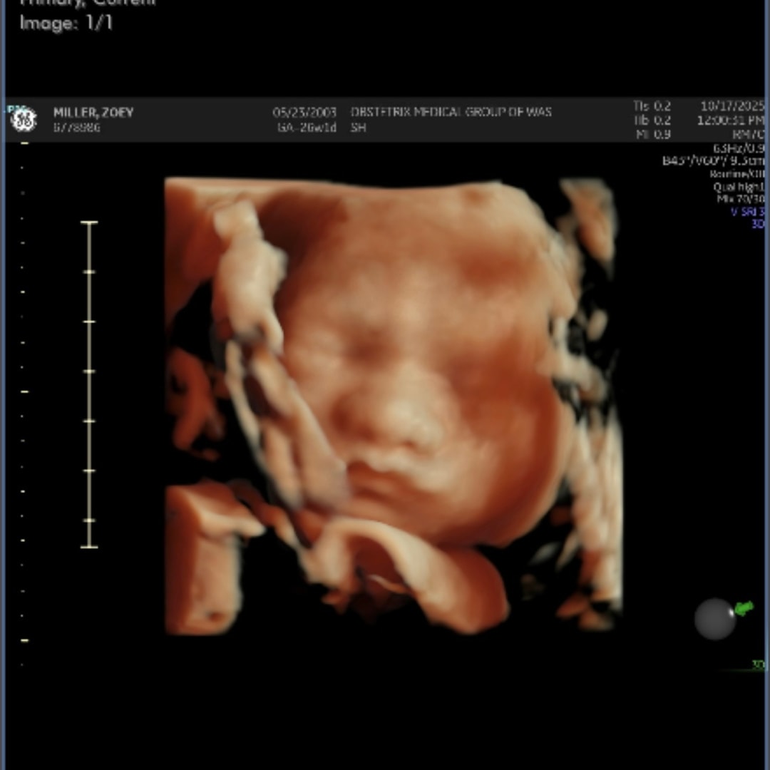 Photo shared by Zoey for their Babylist baby registry.