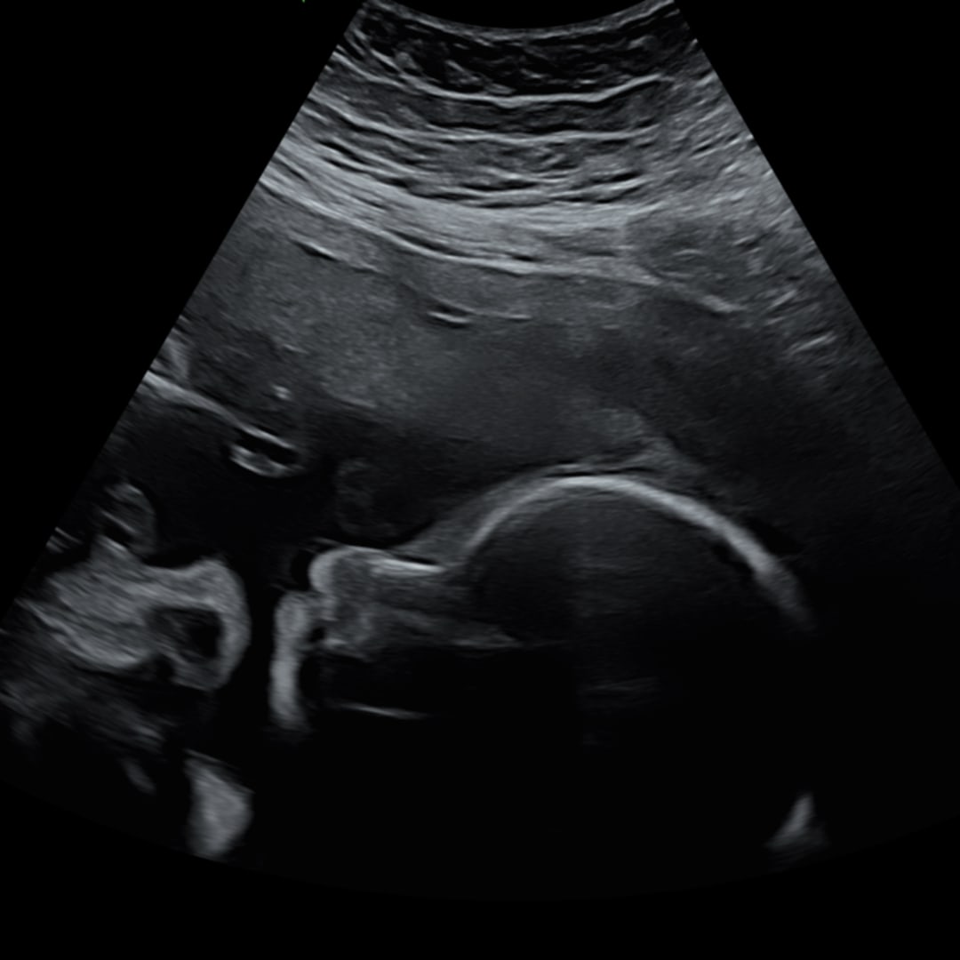 Photo shared by Bryanna for their Babylist baby registry.