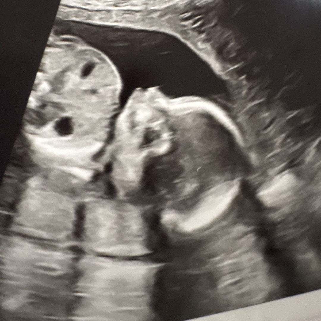 Photo shared by Elizabeth for their Babylist baby registry.
