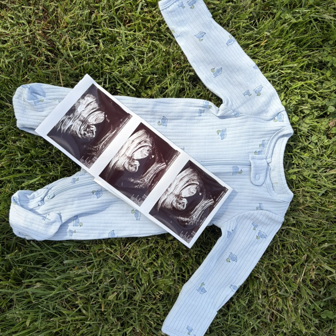 Photo shared by Amanda for their Babylist baby registry.