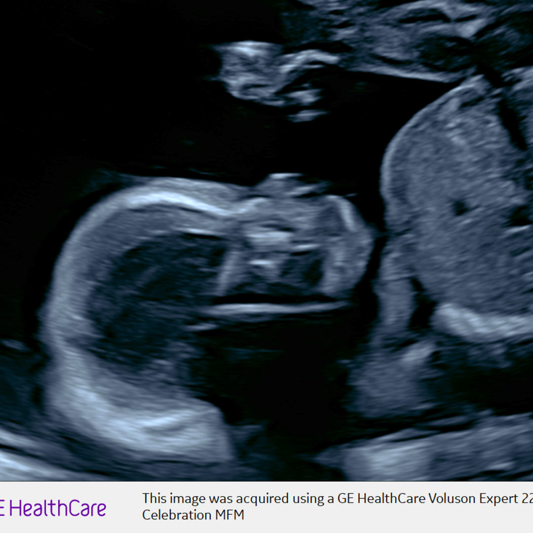 Photo shared by Raechel for their Babylist baby registry.