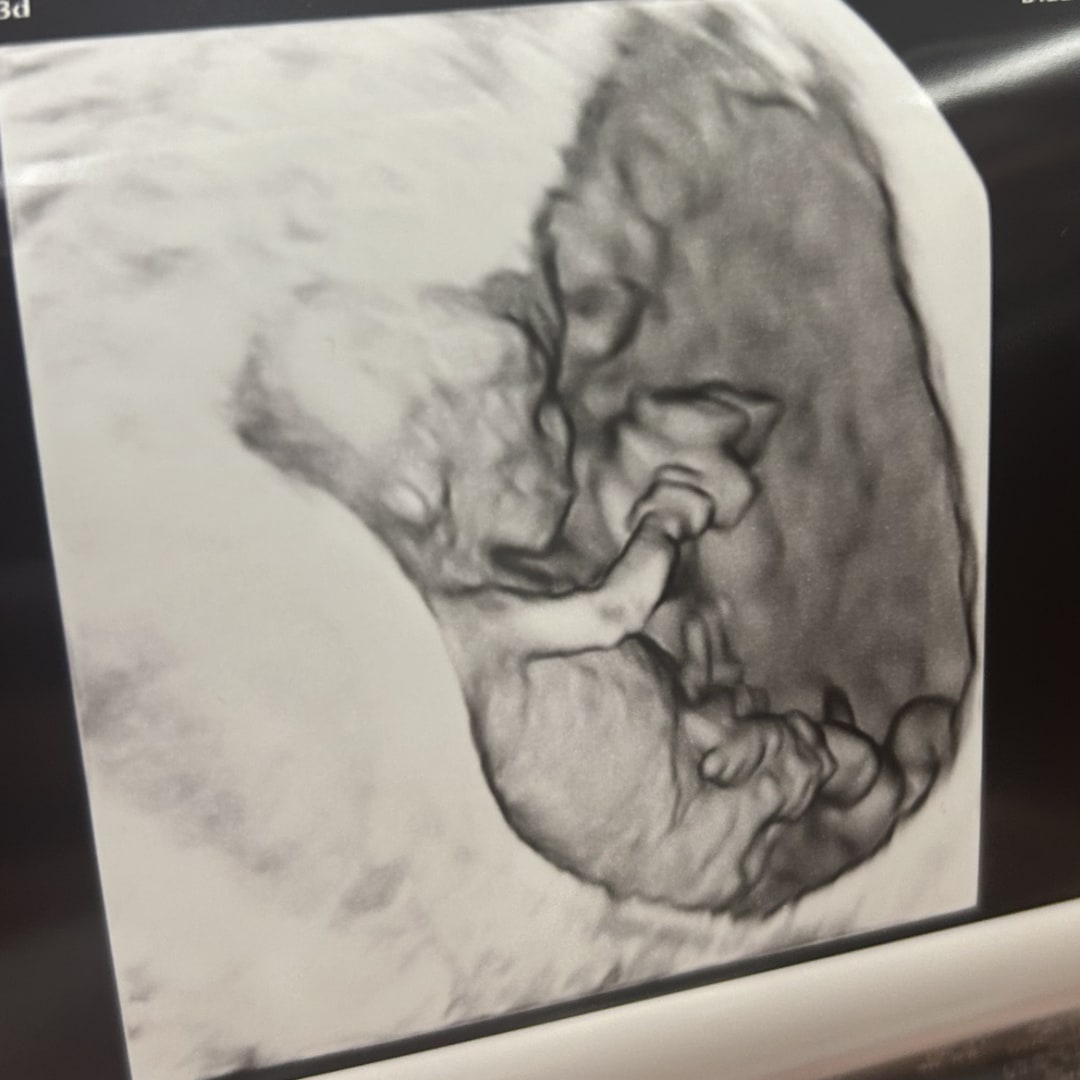 Photo shared by Madison for their Babylist baby registry.
