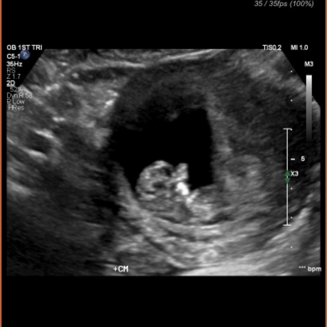 Photo shared by Dayna for their Babylist baby registry.