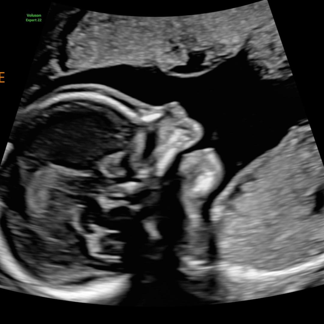 Photo shared by Cheyenne for their Babylist baby registry.