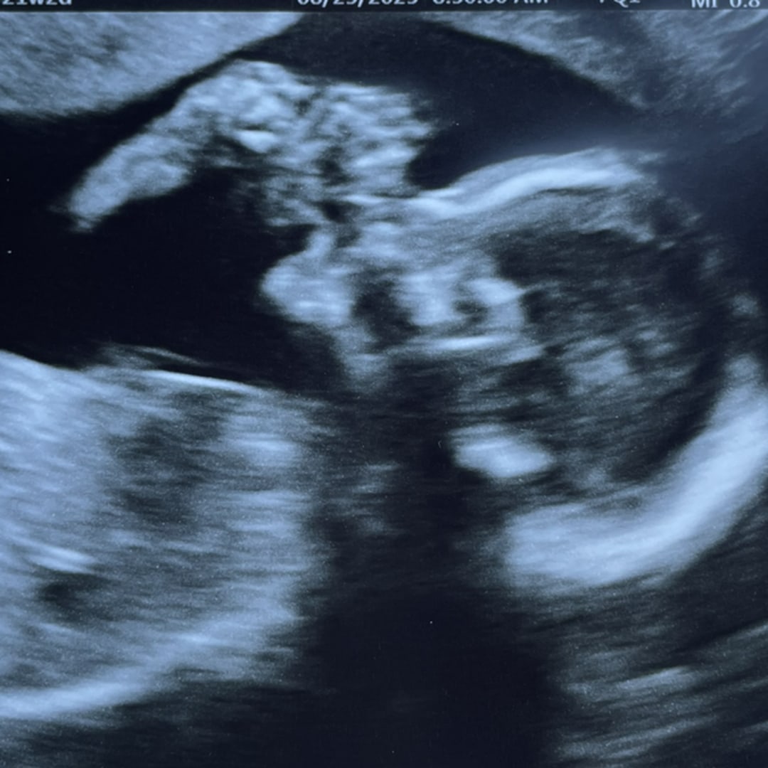 Photo shared by Alejandra for their Babylist baby registry.