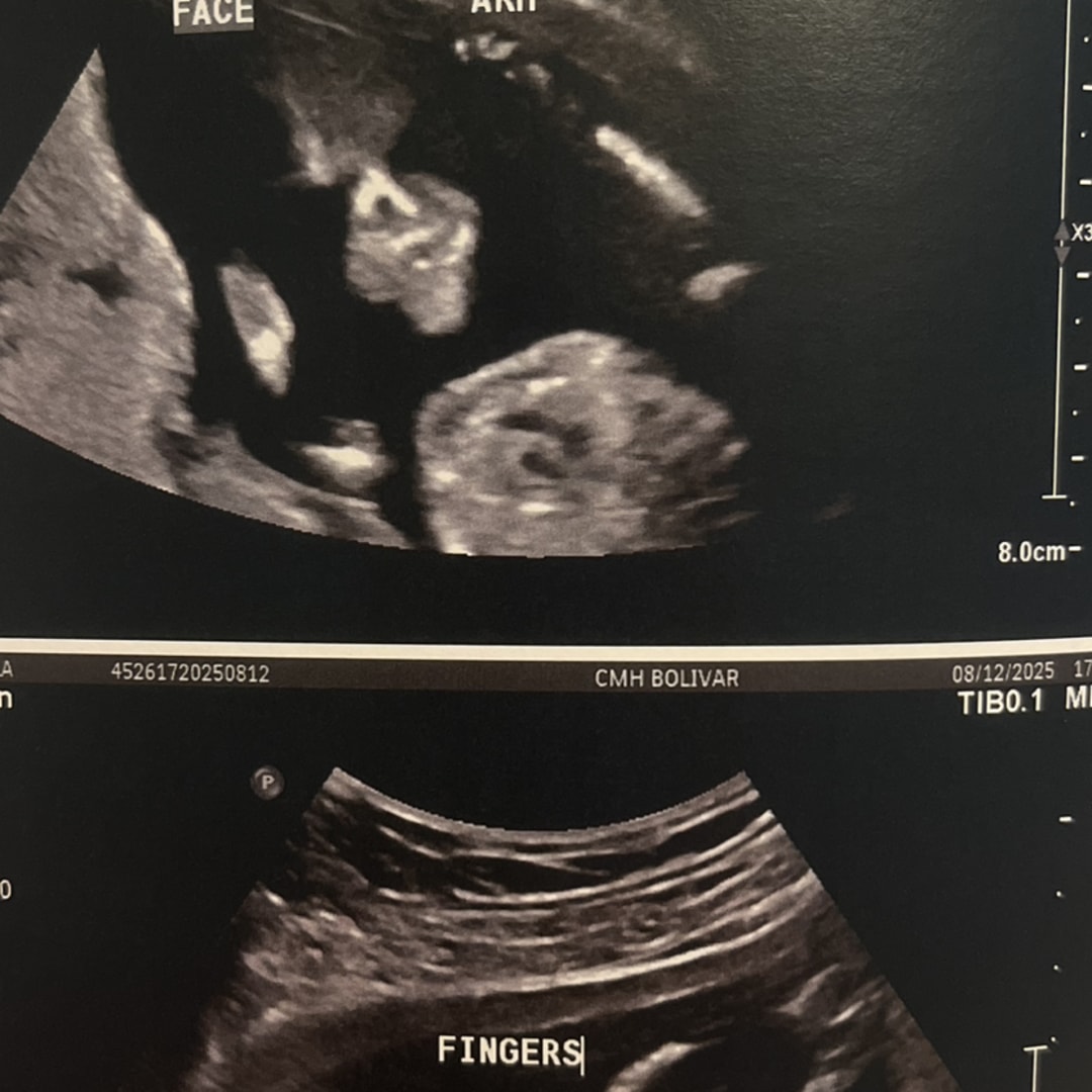 Photo shared by Kayla for their Babylist baby registry.