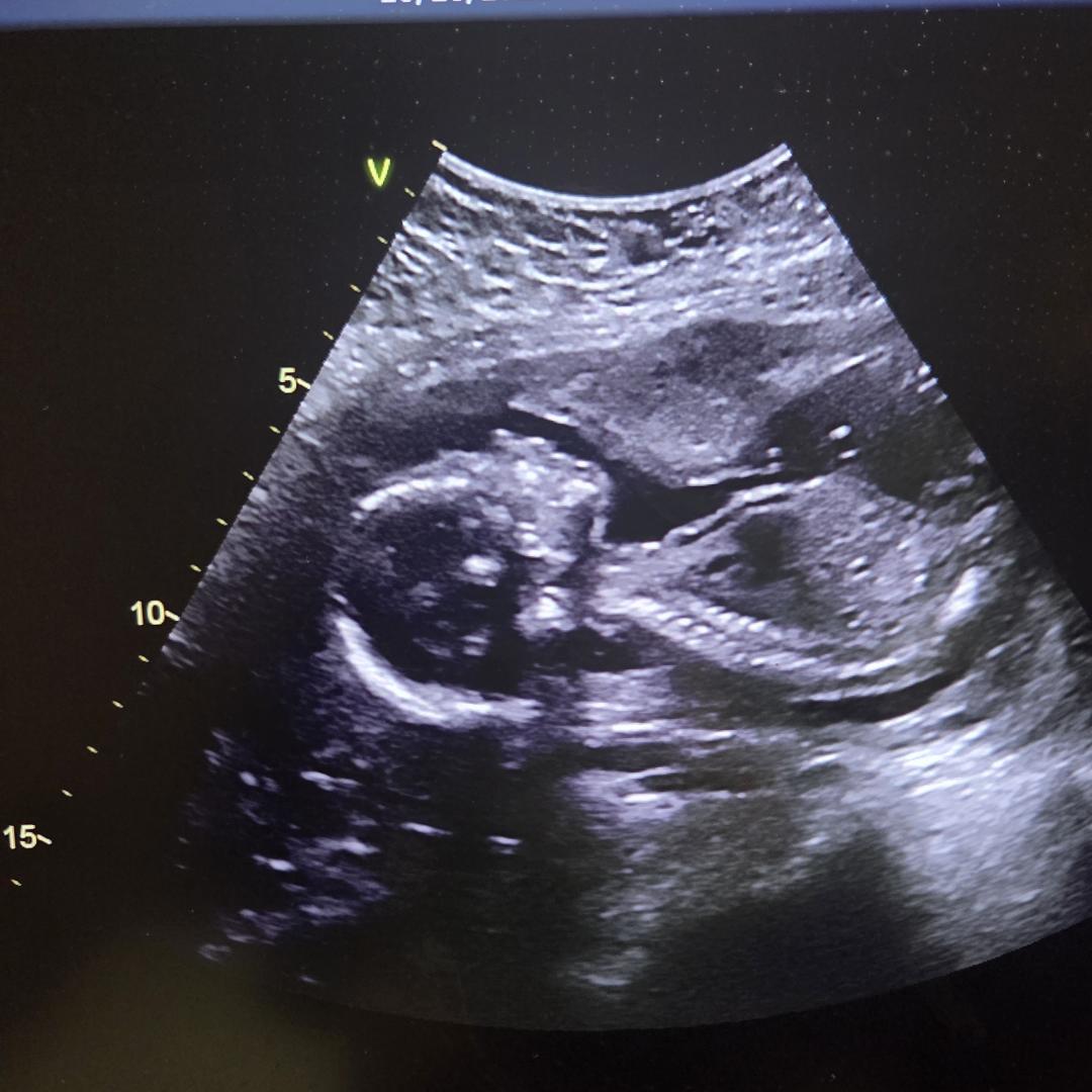 Photo shared by Sarah for their Babylist baby registry.