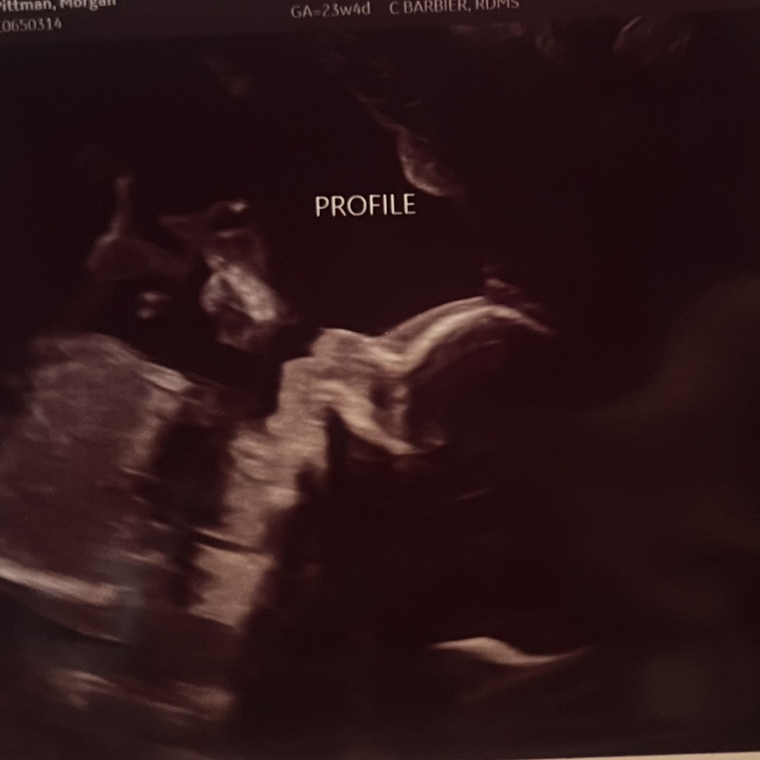 Photo shared by Morgan for their Babylist baby registry.