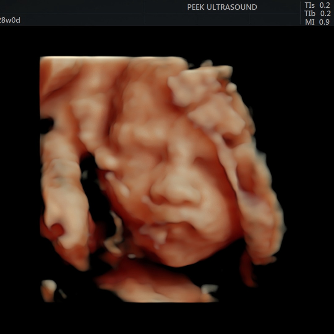 Photo shared by Yamileth for their Babylist baby registry.