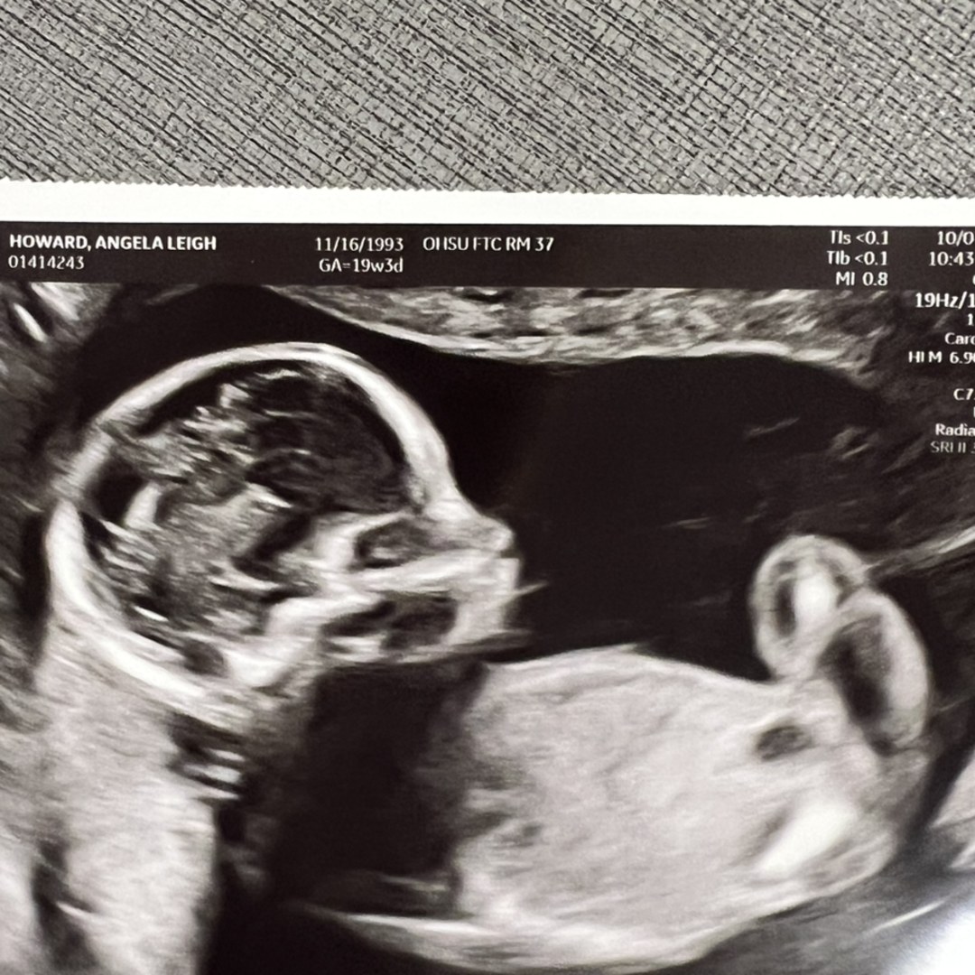 Photo shared by Angela for their Babylist baby registry.