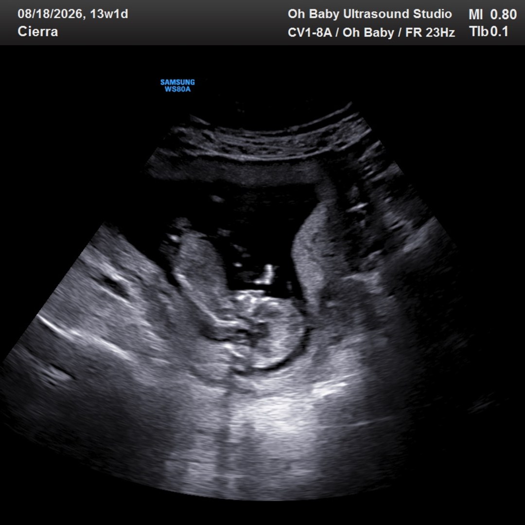 Photo shared by Cierra for their Babylist baby registry.