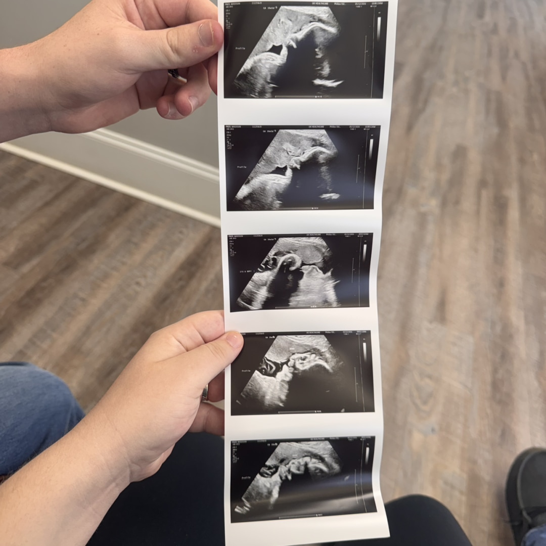 Photo shared by Maddie for their Babylist baby registry.