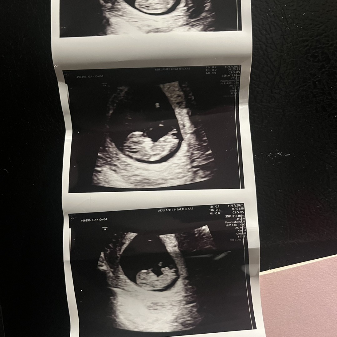 Photo shared by Kalyn for their Babylist baby registry.