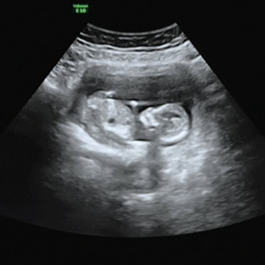 Photo shared by Paige for their Babylist baby registry.