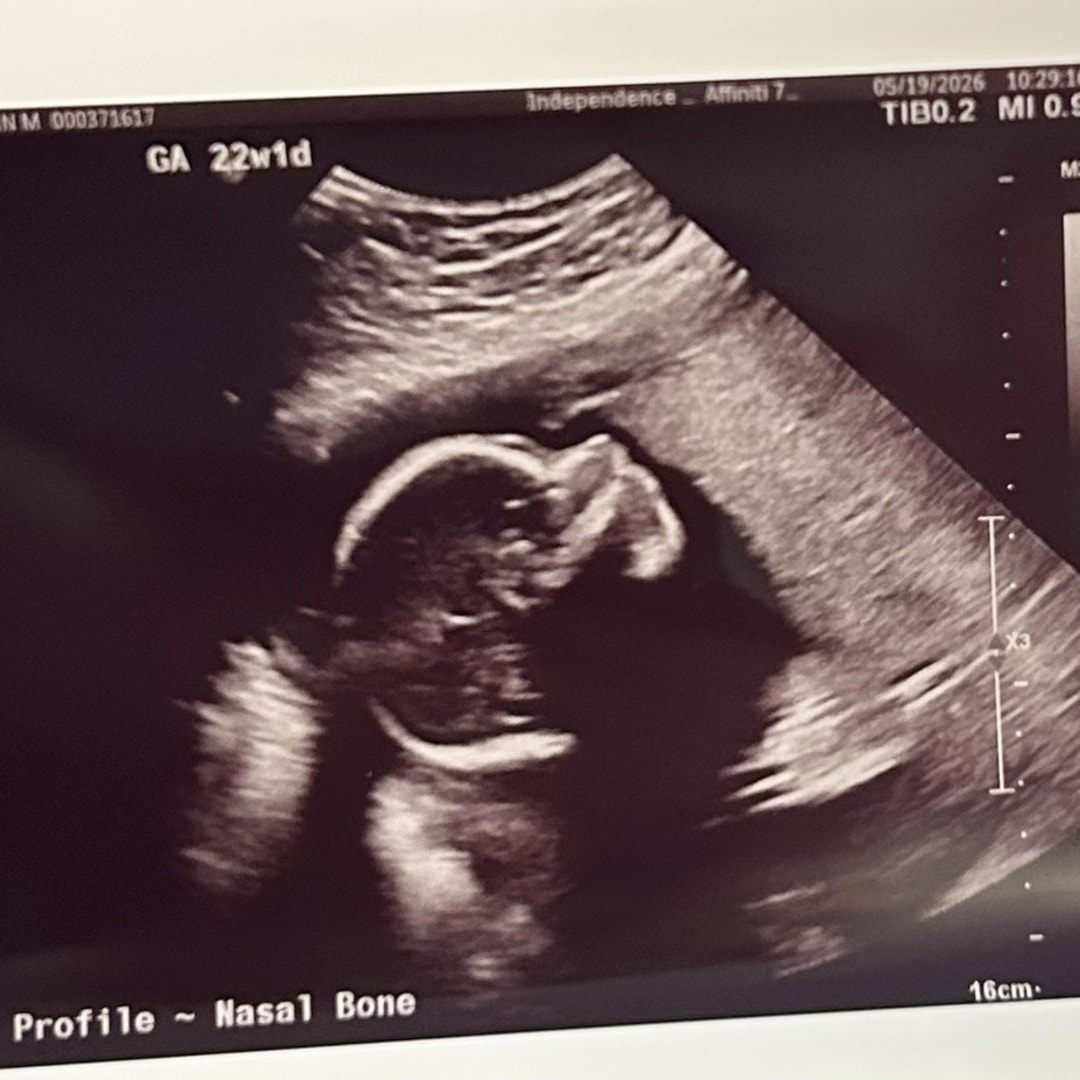 Photo shared by Autumn for their Babylist baby registry.