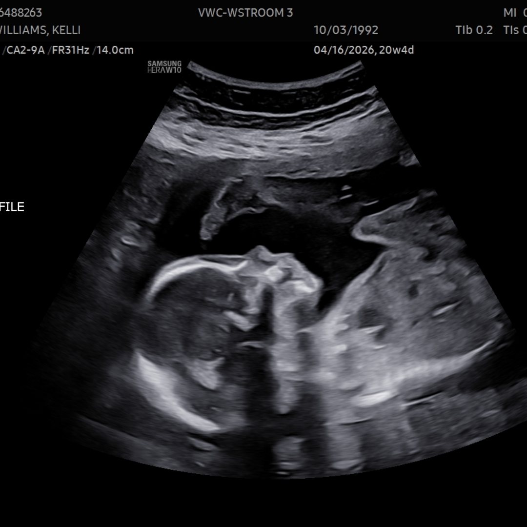 Photo shared by Kaylee for their Babylist baby registry.