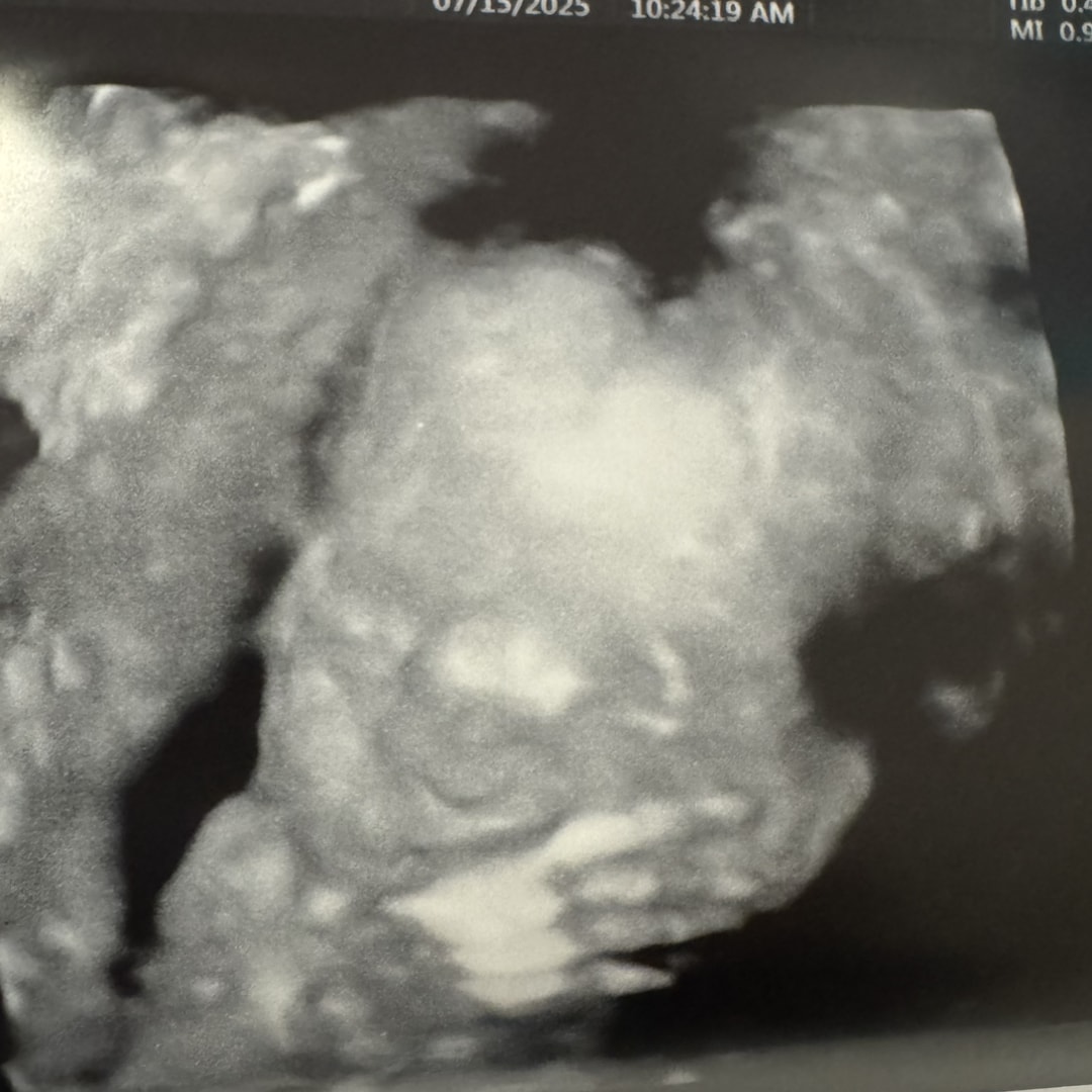 Photo shared by Jenna for their Babylist baby registry.