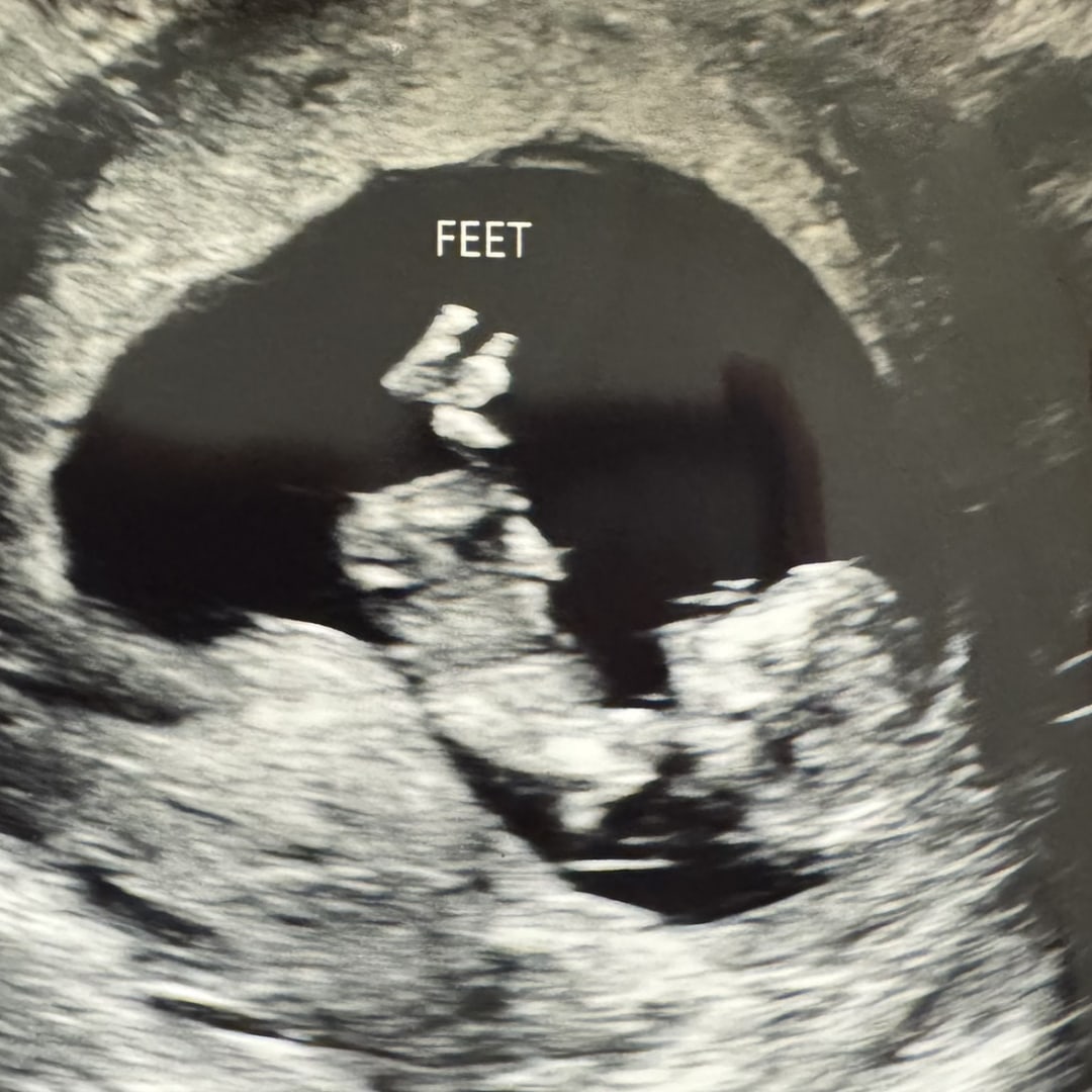 Photo shared by Kayci for their Babylist baby registry.