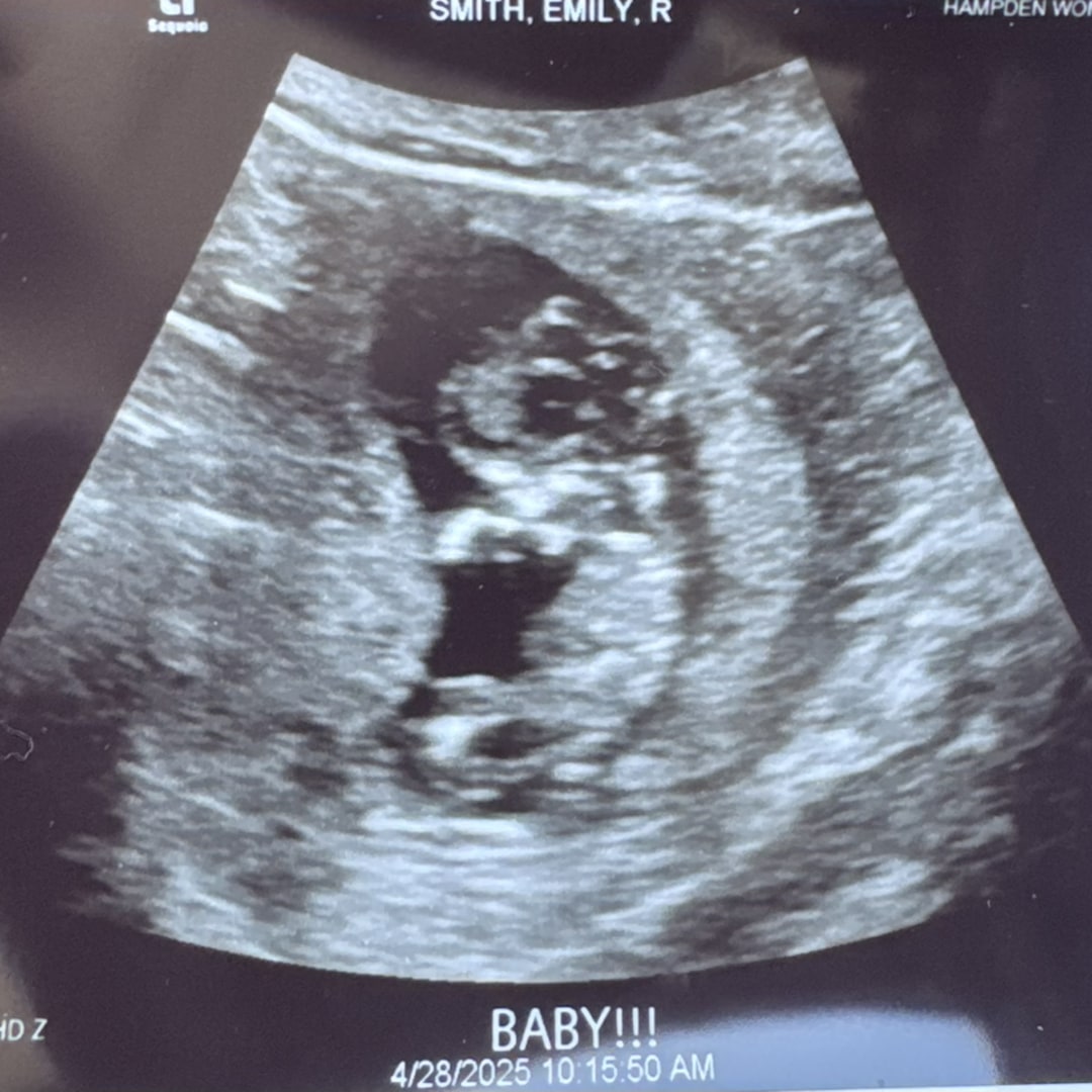 Photo shared by Emily for their Babylist baby registry.