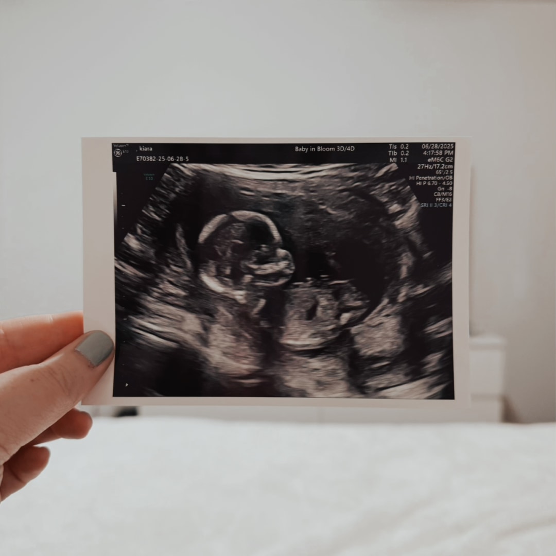 Photo shared by Kiara for their Babylist baby registry.
