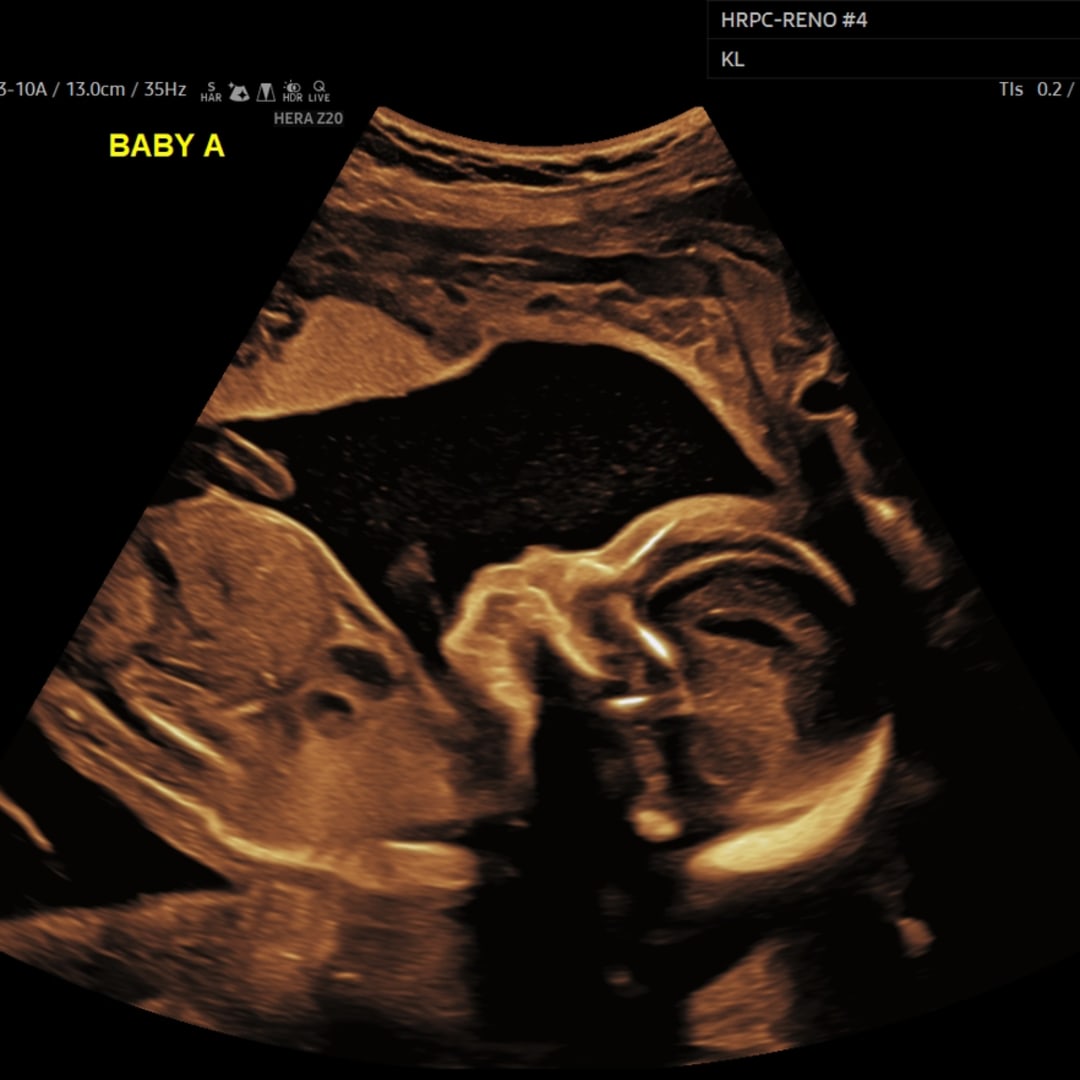 Photo shared by Linsey for their Babylist baby registry.