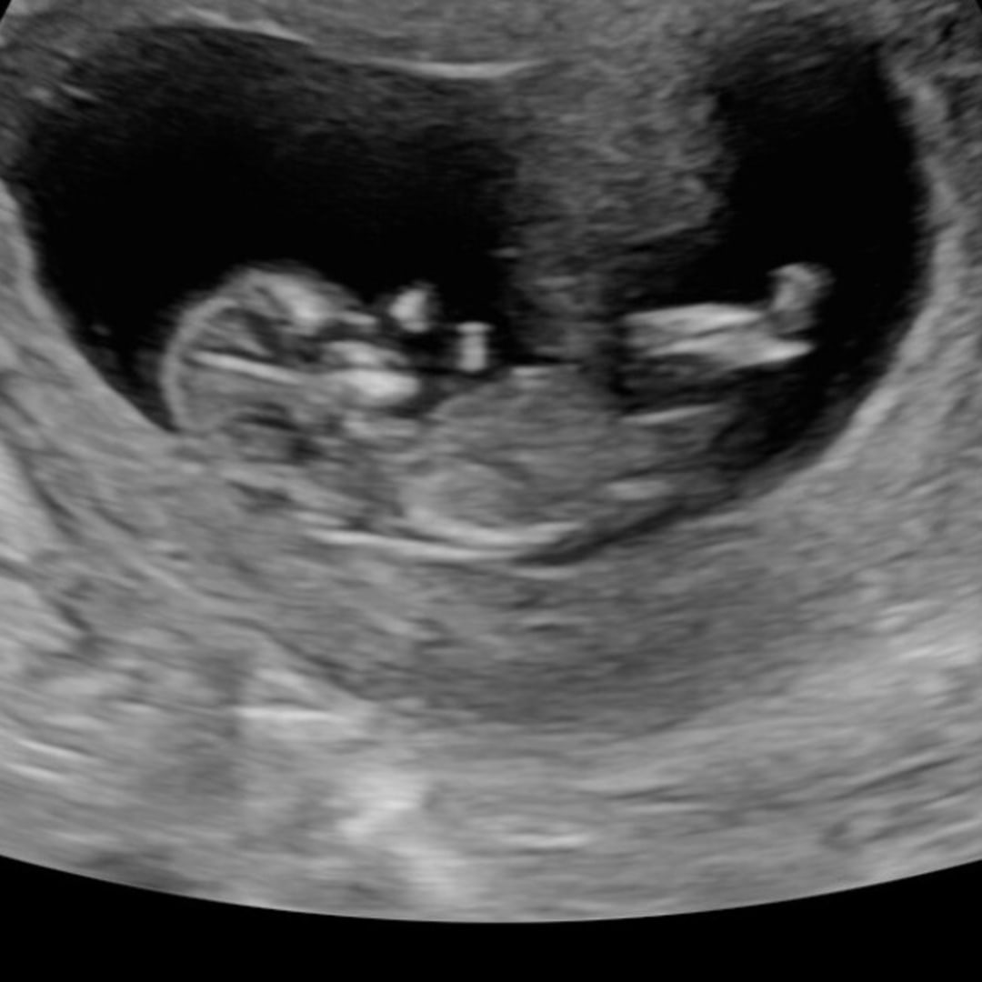 Photo shared by Brittany for their Babylist baby registry.