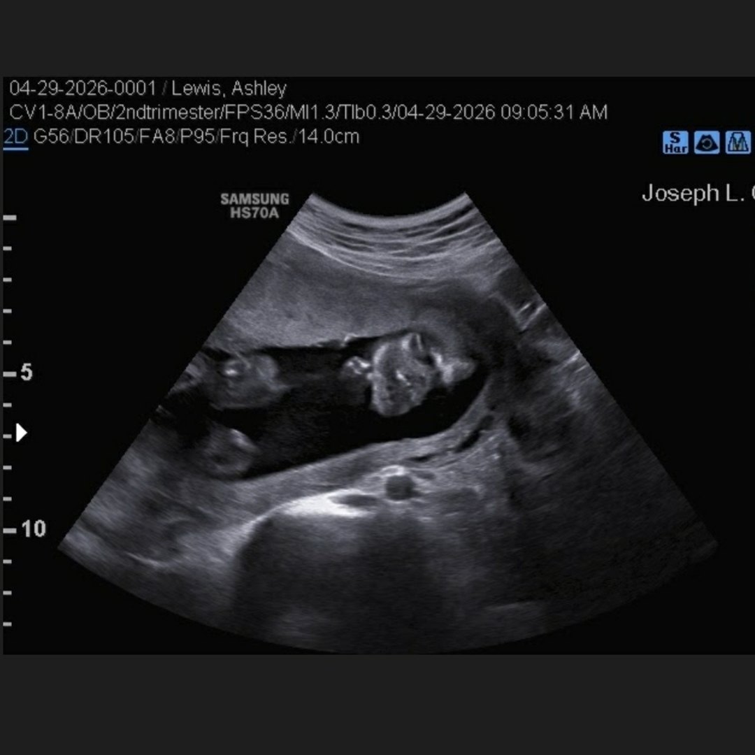 Photo shared by Ashley for their Babylist baby registry.