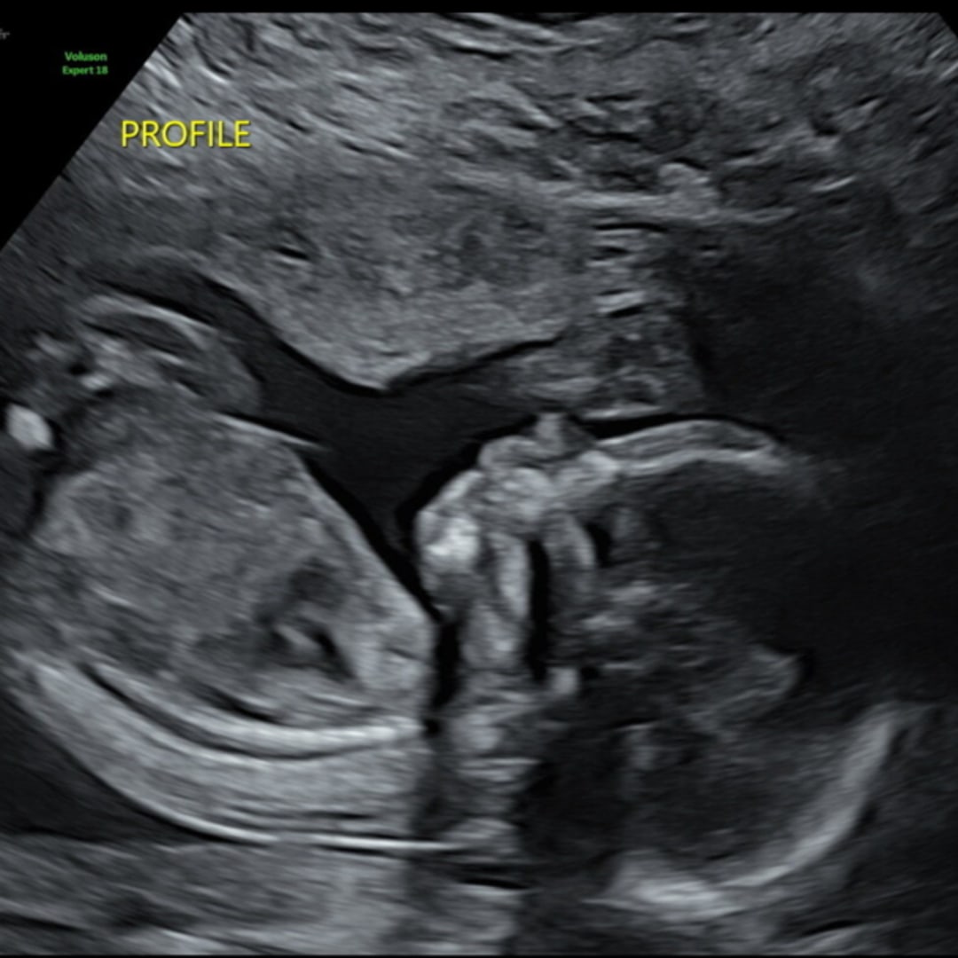 Photo shared by Ameyah for their Babylist baby registry.